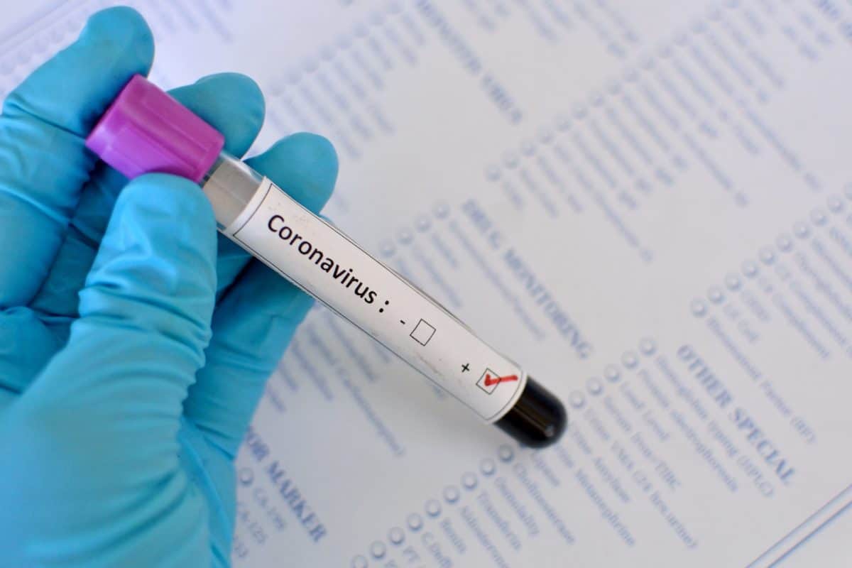 Coronavirus Nigeria scaled